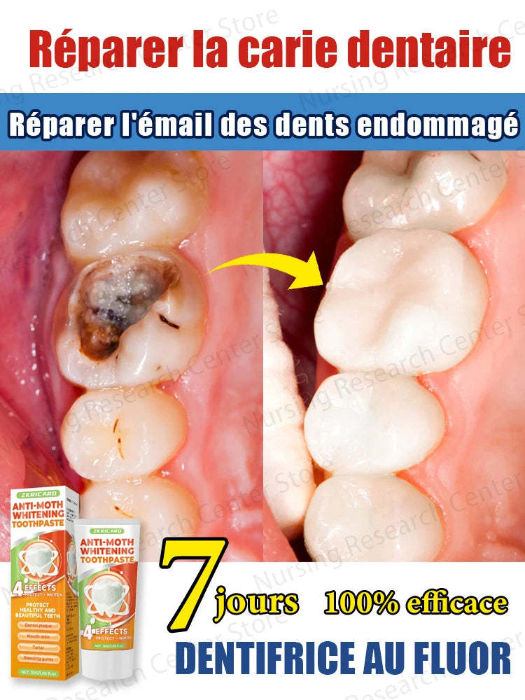 Nettoyer la surface des dents et protéger les gencives