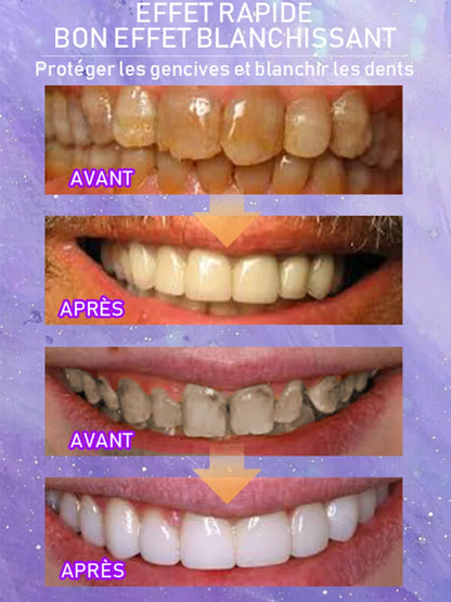 Nettoyer la surface des dents et protéger les gencives