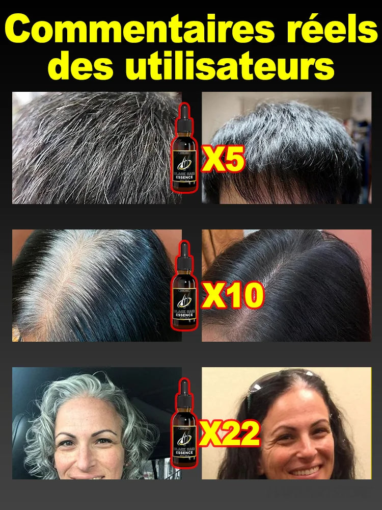 Huile essentielle pour réparer les cheveux, nourrissante pour les cheveux blancs