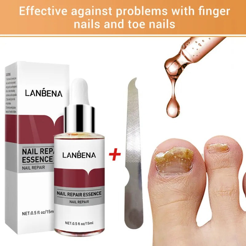 LANBENA – sérum de réparation des ongles, liquide, nourrissant, éclaircissant