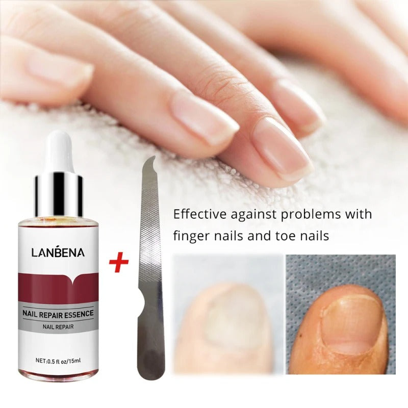 LANBENA – sérum de réparation des ongles, liquide, nourrissant, éclaircissant